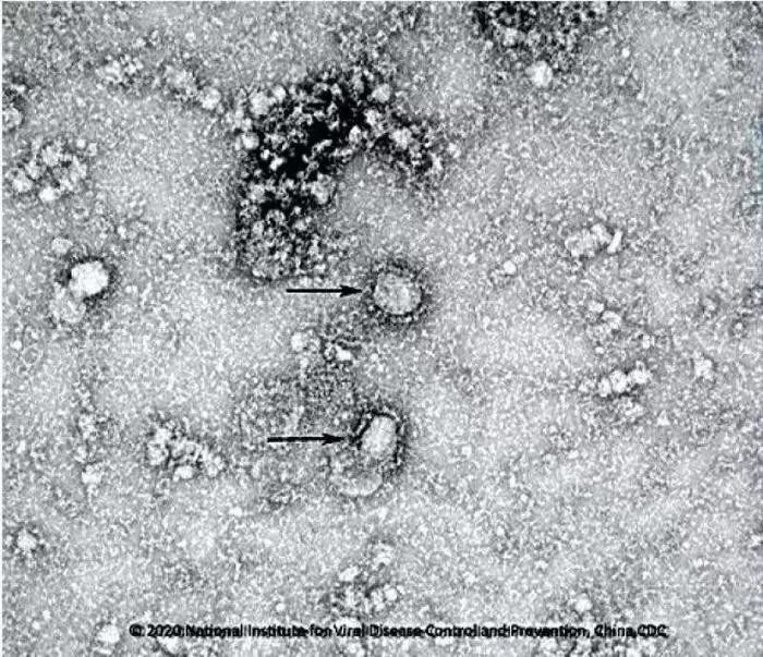 肺炎救星出现？病毒毒种成功分离 抑制剂已在路上